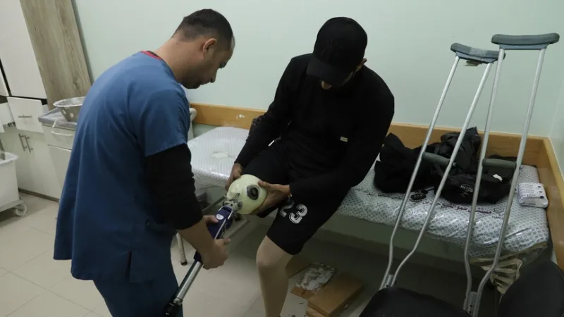 In Gaza, das unter israelischer Blockade steht, warten Palästinenser monatelang darauf, eine Prothese zu erhalten