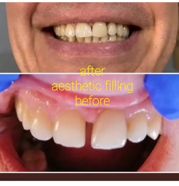 Alanya HEALTHY TEETH Dental Aesthetic — Léky v Alanyi: Online objednávka, ceny a recenze