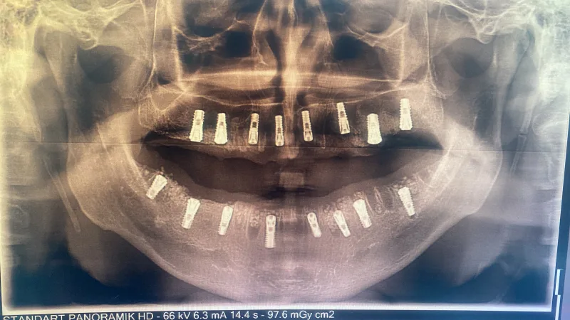 Alanya HEALTHY TEETH Dental Aesthetic — Léky v Alanyi: Online objednávka, ceny a recenze